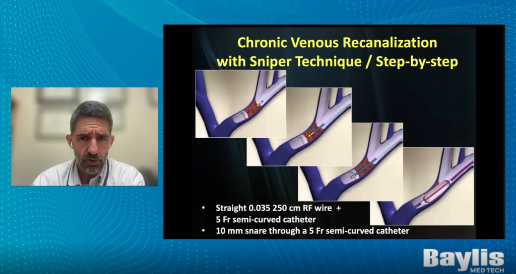 Part 3 Recanalization of Challenging Central Venous Occlusions