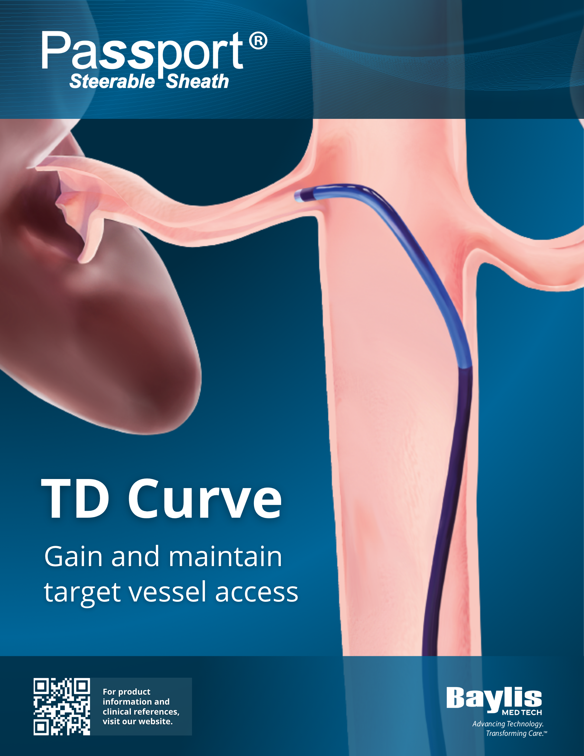 TD Curve Passport Steerable Sheath